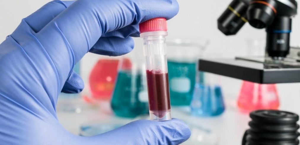 Клинический анализ крови на гепатит